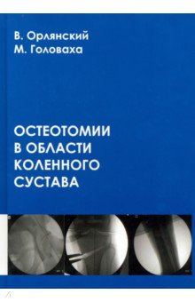 Книга Остеотомии в области коленного сустава на ReadRate.com книга Остеотомии в области коленного сустава