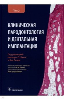 Книга Клиническая пародонтология и дентальная имплантация. В 2-х томах. Том 2 на ReadRate.com книга Клиническая пародонтология и дентальная имплантация. В 2-х томах. Том 2