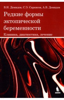 Книга Редкие формы эктопической беременности. Клиника, диагностика, лечение на ReadRate.com книга Редкие формы эктопической беременности. Клиника, диагностика, лечение
