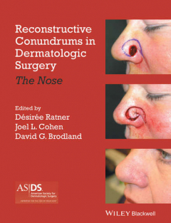 Книга Reconstructive Conundrums in Dermatologic Surgery на ReadRate.com книга Reconstructive Conundrums in Dermatologic Surgery