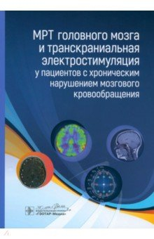 Книга МРТ головного мозга и транскраниальная электростимуляция у пациентов с хроническим нарушением на ReadRate.com книга МРТ головного мозга и транскраниальная электростимуляция у пациентов с хроническим нарушением