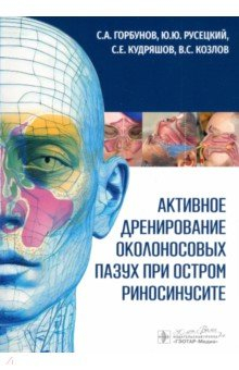 Книга Активное дренирование околоносовых пазух при остром риносинусите на ReadRate.com книга Активное дренирование околоносовых пазух при остром риносинусите
