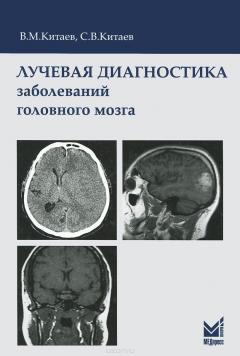 Книга Лучевая диагностика заболеваний головного мозга на ReadRate.com книга Лучевая диагностика заболеваний головного мозга