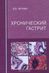 книга Хронический гастрит
