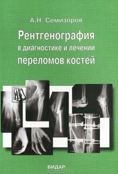 Книга Рентгенография в диагностике и лечении переломов костей на ReadRate.com книга Рентгенография в диагностике и лечении переломов костей