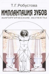 книга Имплантация зубов. Хирургические аспекты