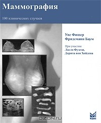 Книга Маммография. 100 клинических случаев на ReadRate.com книга Маммография. 100 клинических случаев