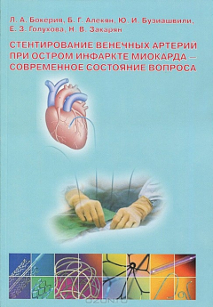 Книга Стентирование венечных артерий при остром инфаркте миокарда – современное состояние вопроса на ReadRate.com книга Стентирование венечных артерий при остром инфаркте миокарда – современное состояние вопроса